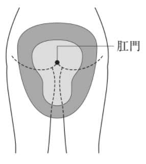 選択肢1画像