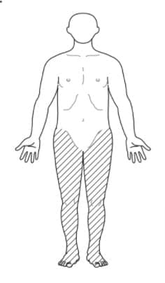 選択肢2画像