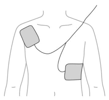 選択肢1画像