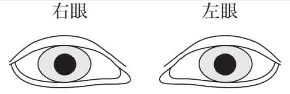 選択肢1画像