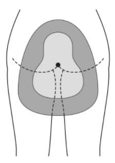 選択肢3