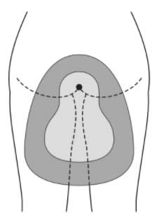 選択肢4