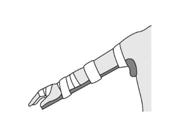 選択肢2