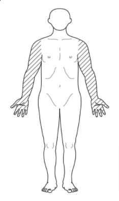 選択肢1