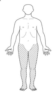 選択肢2