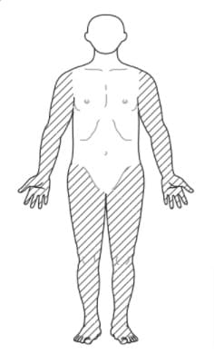 選択肢4