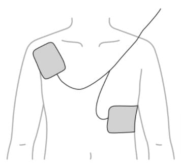 選択肢1