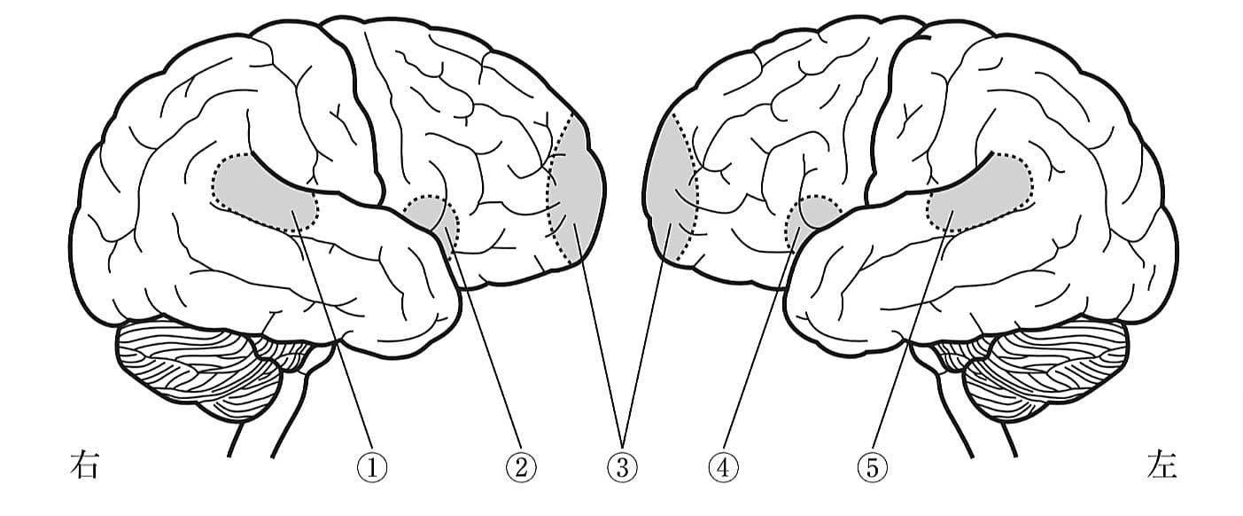 脳の外側面を左右から見た模式図を示す。 右利きの健常成人のBroca〈ブローカ〉の運動性言語中枢はどれか。