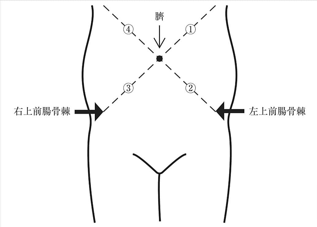 次の文を読み以下の問いに答えよ。 Aさん（30歳、初産婦）はX年2月5日に妊婦健康診査のために来院した。 受診日はX年2月5日、分娩予定日はX年2月28日である。 AさんにLeopold〈レオポルド〉触診法で触診を行ったところ、第2胎向で、子宮底付近にやや柔らかい球状の塊を、恥骨結合側に硬い球状のものを触れた。腹部前面を図に示す。 Aさんの胎児心音聴取部位で適切なのはどれか。