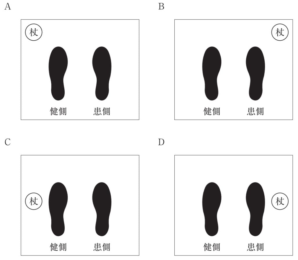 患者の足底と杖をつく位置を図に示す。 両上肢の動きに制限がなく、右下肢に軽度の筋力低下がある患者の三点歩行で、歩き始めの杖の位置が適切なのはどれか。